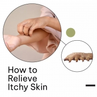 How to Relieve Itchy Skin