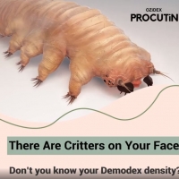 Don't Look Now, But There Are Critters on Your Face!