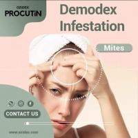 Demodex Infestation PickP