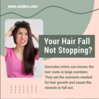 Are you one of those who have been chronically suffering from hair loss?