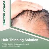 Hair Thinning solution