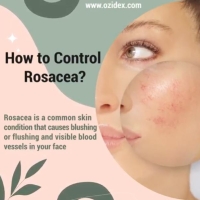 How to control rosacea?