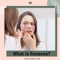 What is Rosacea? ðŸ¤” PickP