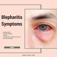 Blepharitis Symptoms PickP